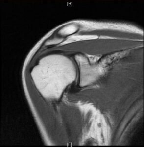 MRI image