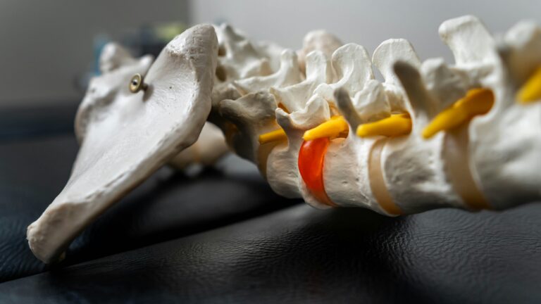 spine model